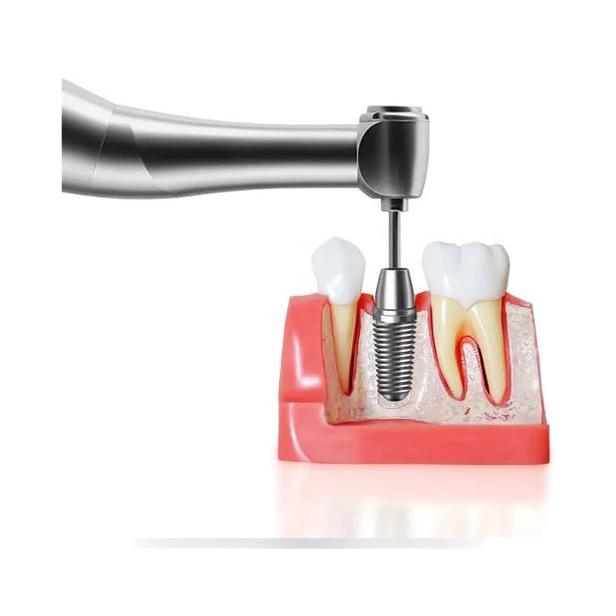Clé dynamométrique électrique sans fil More Dent BR-216 et son coffret de 16 tournevis